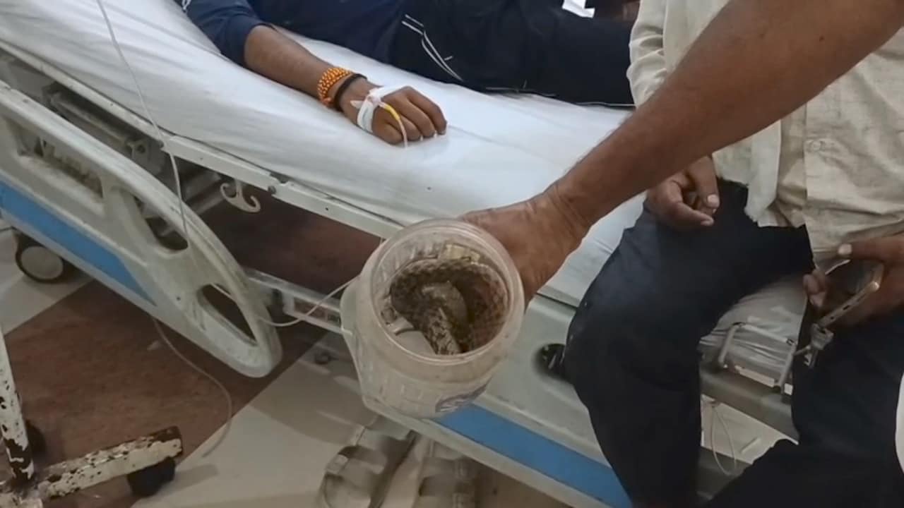 Snake Bite: सर्पदंश के शिकार 6 लोगों के साथ अस्पताल पहुंचा 'सांप', देखकर डॉक्टरों के उड़े होश