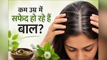 आयुर्वेदाचार्य का दावा- पहले से सफेद बालों को काला करेंगे ये आयुर्वेदिक नुस्खे, और बाल दोबारा सफेद नहीं होंगे