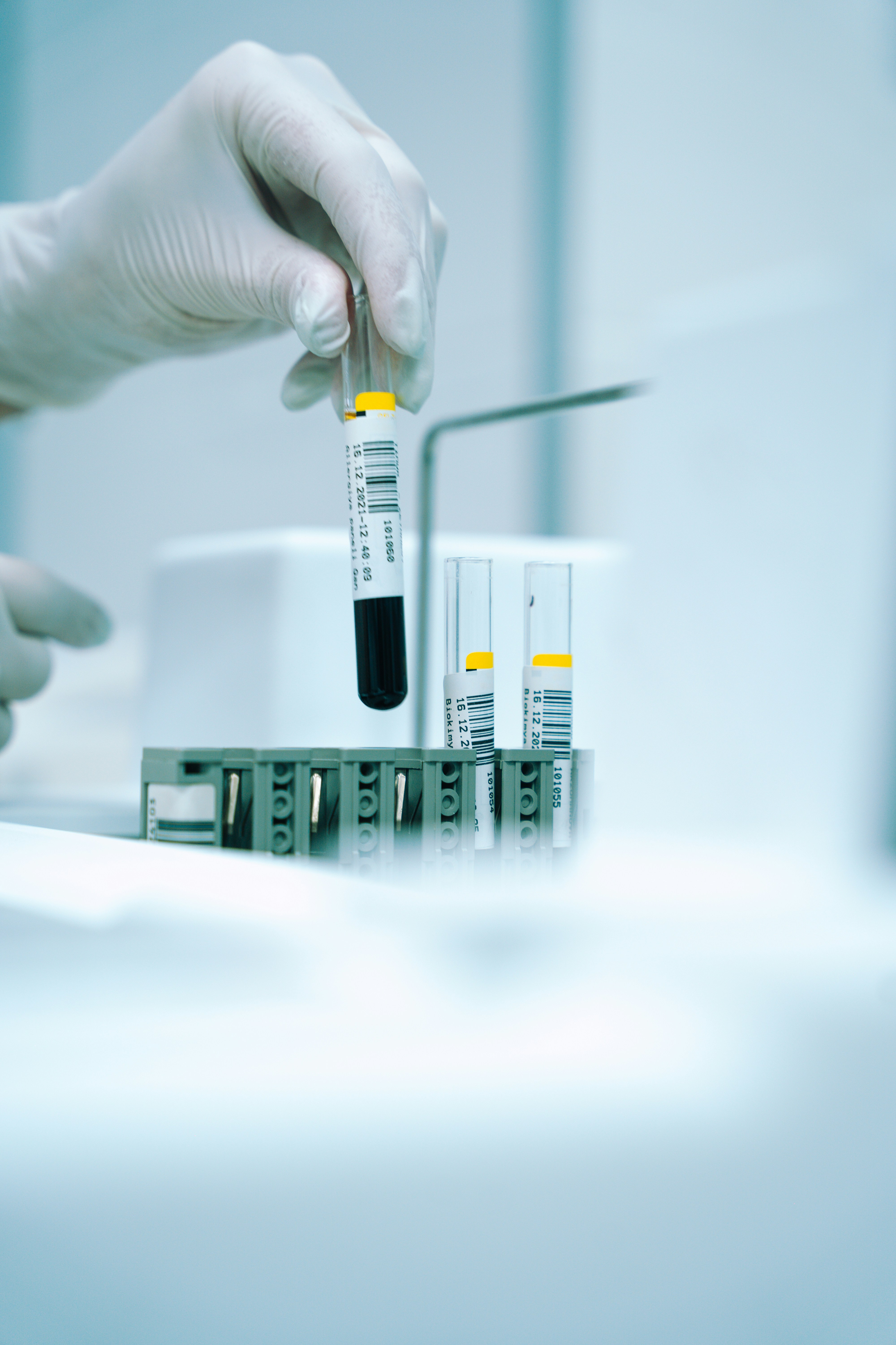 Dr Reddy’s shares fall on semaglutide batch quality issue and supply delays