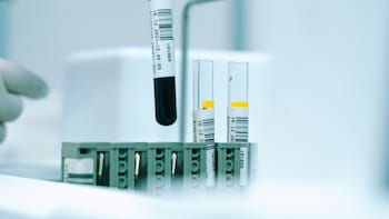 Dr Reddy's Shares Slide Over 4% After Semaglutide Batch Quality Concern