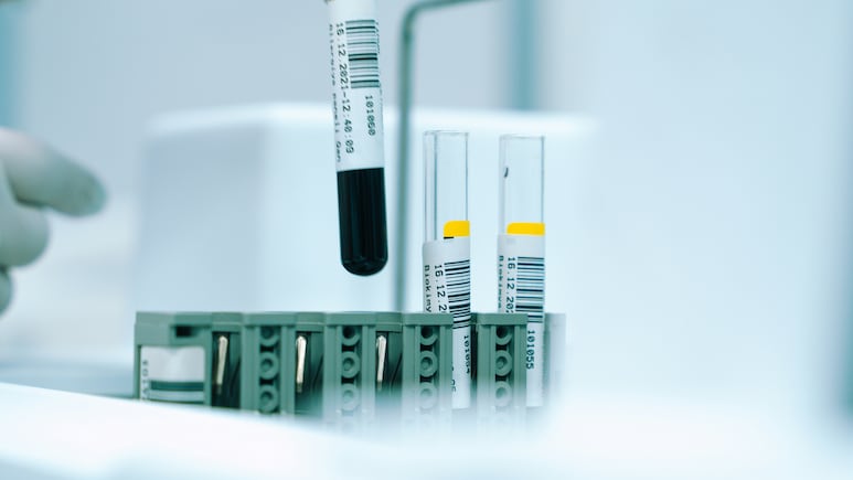 Dr Reddy's Shares Slide Over 6% After Semaglutide Batch Quality Concern