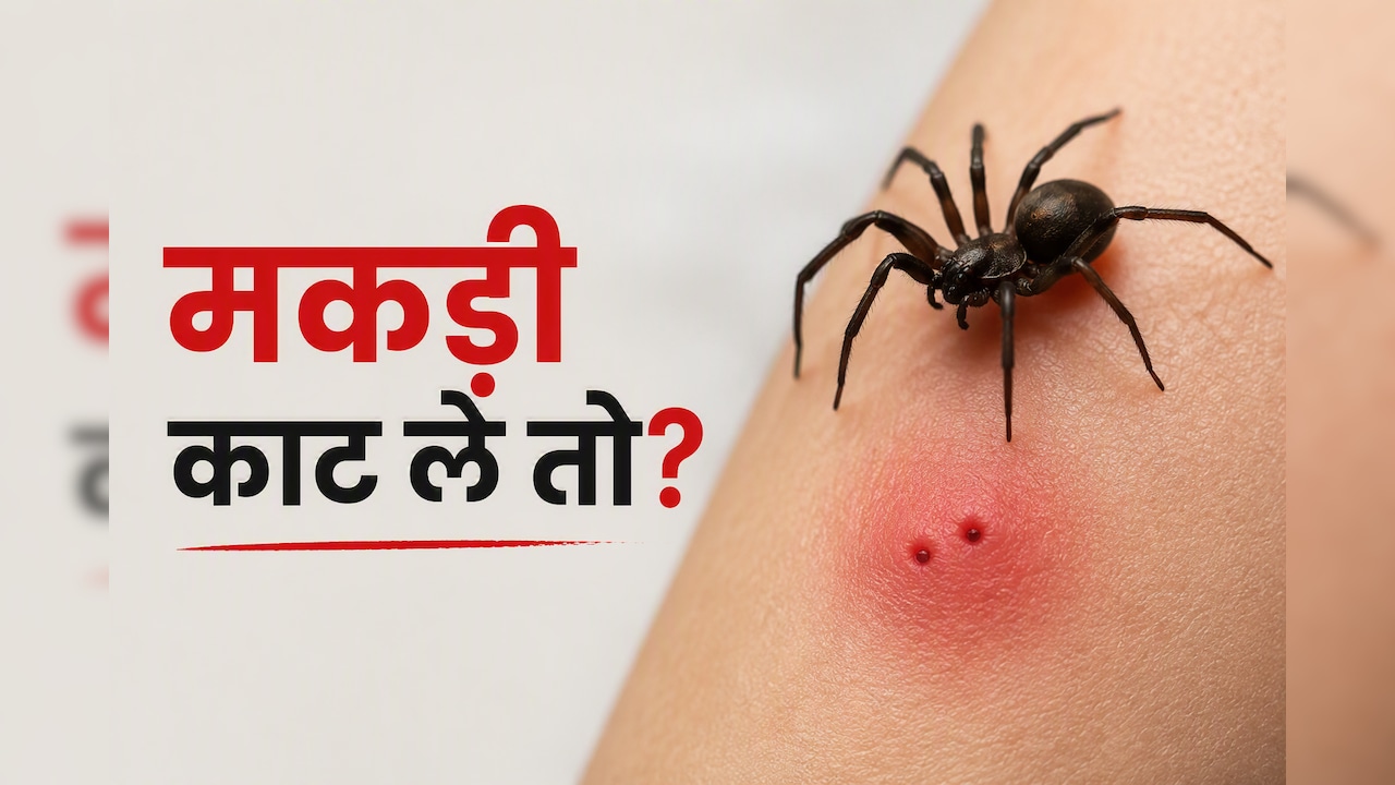 मकड़ी काट ले तो क्या करें? WHO के Technical Advisor ने बताया क्या करें और क्या नहीं