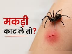 मकड़ी काट ले तो क्या करें? WHO के Technical Advisor ने बताया क्या करें और क्या नहीं