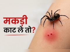 मकड़ी काट ले तो क्या करें? WHO के Technical Advisor ने बताया क्या करें और क्या नहीं
