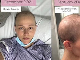 Breast Cancer Survivor Shares What Her Hair Looks Like After Chemotherapy