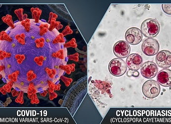 July Health Wrap: Explosive Diarrhea To Covid Surge, 10 Stories That Defined The Month