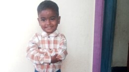 Four-Year-Old's Scalp Torn In A Brutal Stray Dog Attack In Karnataka