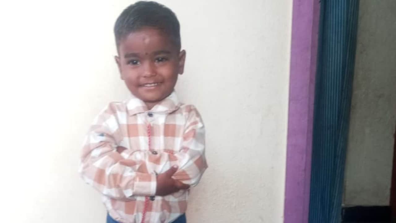 Dragged, Bitten, Scalp Torn: 4-Year-Old Attacked By Stray Dog In Karnataka