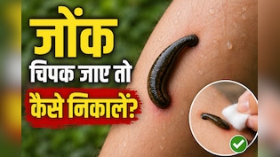 शरीर से जोंक चिपक जाए तो कैसे हटाएं? किन गलतियों को करने से बचना है जरूरी