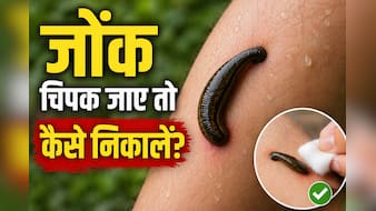 शरीर से जोंक चिपक जाएं तो कैसे हटाएं? किन गलतियों को करने से बचना है जरूरी