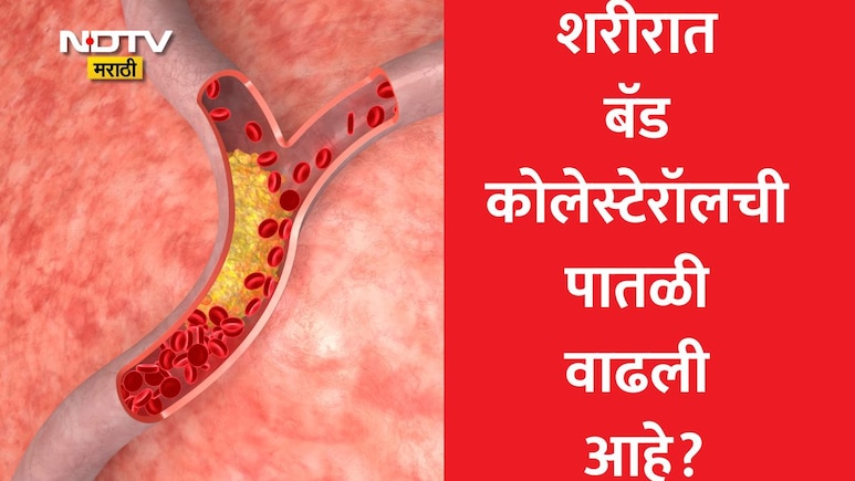 High Cholesterol Symptoms: ब्लड रिपोर्टमध्ये हाय कोलेस्टेरॉल वाढल्यानं टेन्शन आलंय? HDL, LDL, VLDL किती असावं?