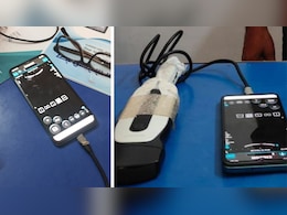 मोबाइल से भ्रूण लिंग की करता था जांच, जोधपुर में नर्सिंग होम संचालक पर शिकंजा