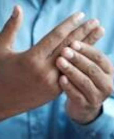 Tips To Get Rid Of Excessive Uric Acid