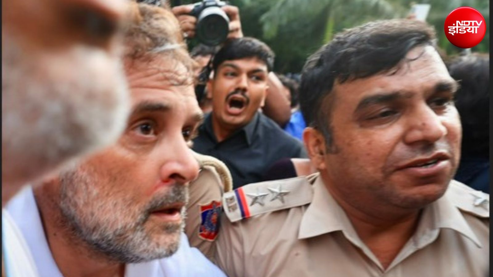 राहुल गांधी की नाक से बहता दिखा खून, पीएम आवास के बाहर पुलिस से धक्का-मुक्की में चोटिल