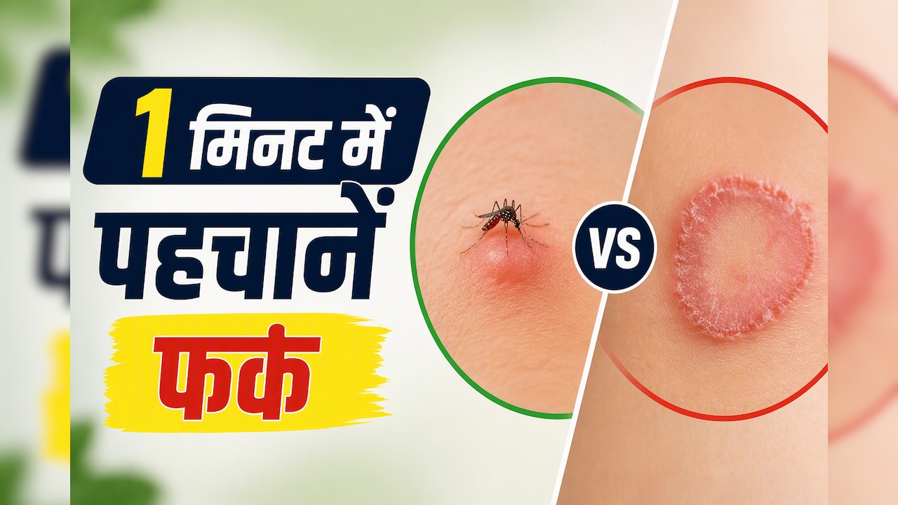 मैं 2 हफ्ते तक इसे मच्छर का काटना समझता रहा, आखिर में निकला फंगल इंफेक्शन 