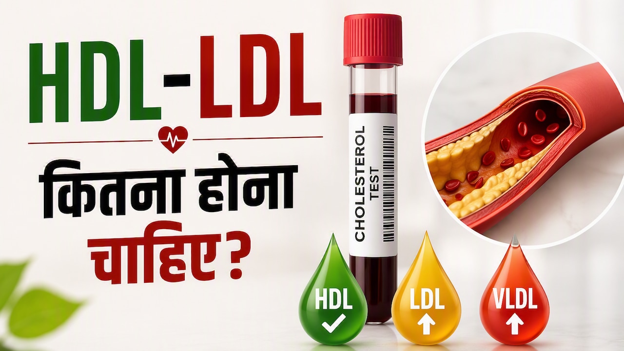 ब्लड रिपोर्ट में हाई LDL देख कर डर गए? कितना होना चाहिए HDL, LDL, VLDL, ये समझें कोलेस्ट्रॉल का खेल