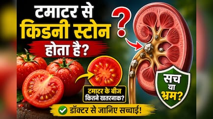 क्या टमाटर या उसके बीज खाने से किडनी स्टोन हो जाता है? जानिए इस आम मिथक का सच
