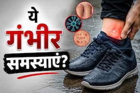 बारिश में भीगे जूते पहनना पड़ सकता है भारी, एक्सपर्ट ने बताई बड़ी वजह