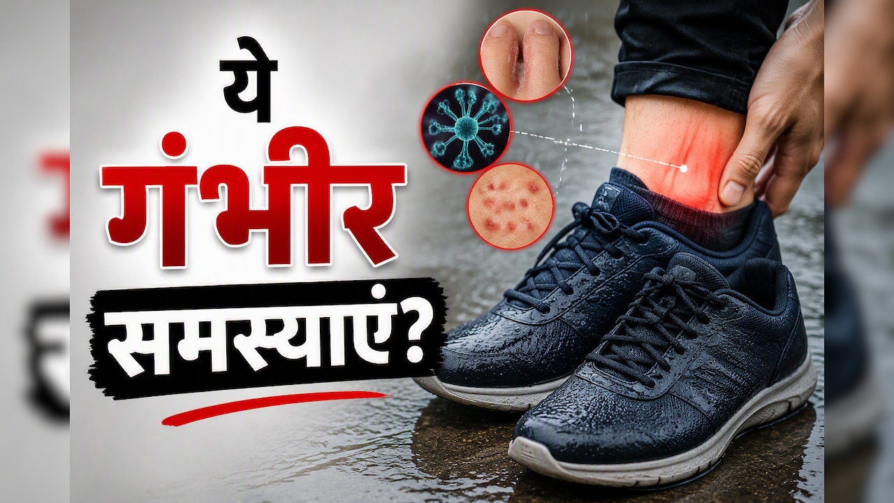 बारिश में भीगे जूते पहनना पड़ सकता है भारी, एक्सपर्ट ने बताई बड़ी वजह