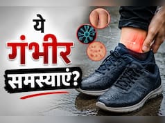 बारिश में भीगे जूते पहनना पड़ सकता है भारी, एक्सपर्ट ने बताई बड़ी वजह