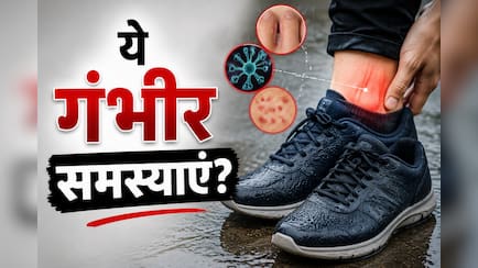 बारिश में भीगे जूते पहनना पड़ सकता है भारी, एक्सपर्ट ने बताई बड़ी वजह