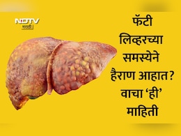 Fatty Liver Food: फॅटी लिव्हरने त्रस्त आहात? काय खावे आणि काय टाळावे? डॉक्टरांनी दिली 5 हेल्दी स्नॅक्सची यादी