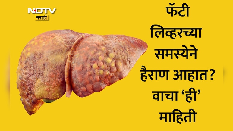 Fatty Liver Food: फॅटी लिव्हरने त्रस्त आहात? काय खावे आणि काय टाळावे? डॉक्टरांनी दिली 5 हेल्दी स्नॅक्सची यादी