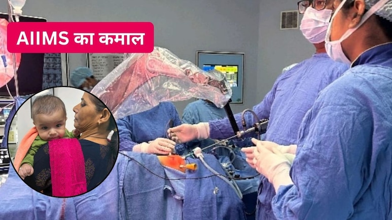 AIIMS के डॉक्टरों का चमत्कार! 4 महीने के बच्चे की फेफड़े बचाने वाली दुर्लभ सर्जरी, 2 ही दिन में मिल गई अस्पताल से छुट्टी