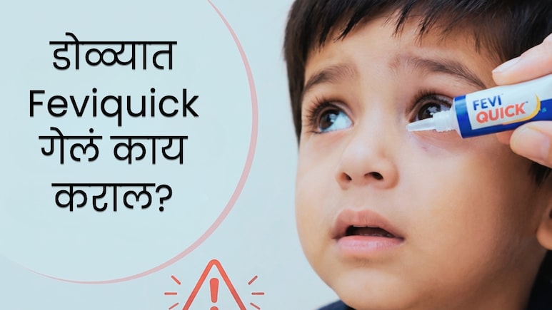 Eye Care : मुलांच्या डोळ्यात चुकून Feviquick गेलं तर काय कराल? तातडीने उचला पाऊलं, डॉक्टरांनी केलं अलर्ट!
