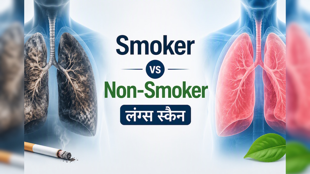 सिगरेट पीने वालों के लंग्स अंदर से कैसे दिखते हैं? आशु सर ने वायरल स्कैन में दिखाया अंतर