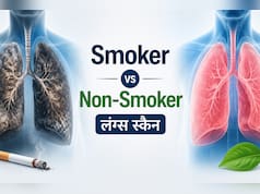 सिगरेट पीने वालों के लंग्स अंदर से कैसे दिखते हैं? आशु सर ने वायरल स्कैन में दिखाया अंतर