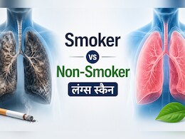 सिगरेट पीने वालों के लंग्स अंदर से कैसे दिखते हैं? आशु सर ने वायरल स्कैन में दिखाया अंतर
