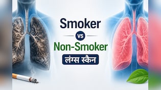 सिगरेट पीने वालों के लंग्स अंदर से कैसे दिखते हैं? आशु सर ने वायरल स्कैन में दिखाया अंतर