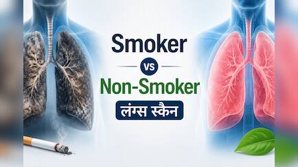 सिगरेट पीने वालों के लंग्स अंदर से कैसे दिखते हैं? आशु सर ने वायरल स्कैन में दिखाया अंतर