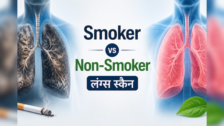 सिगरेट पीने वालों के लंग्स अंदर से कैसे दिखते हैं? आशु सर ने वायरल स्कैन में दिखाया अंतर