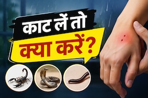 बारिश में घर में घुस आए बिच्छू, सांप या कनखजूरा? काट लें तो सबसे पहले करें ये काम