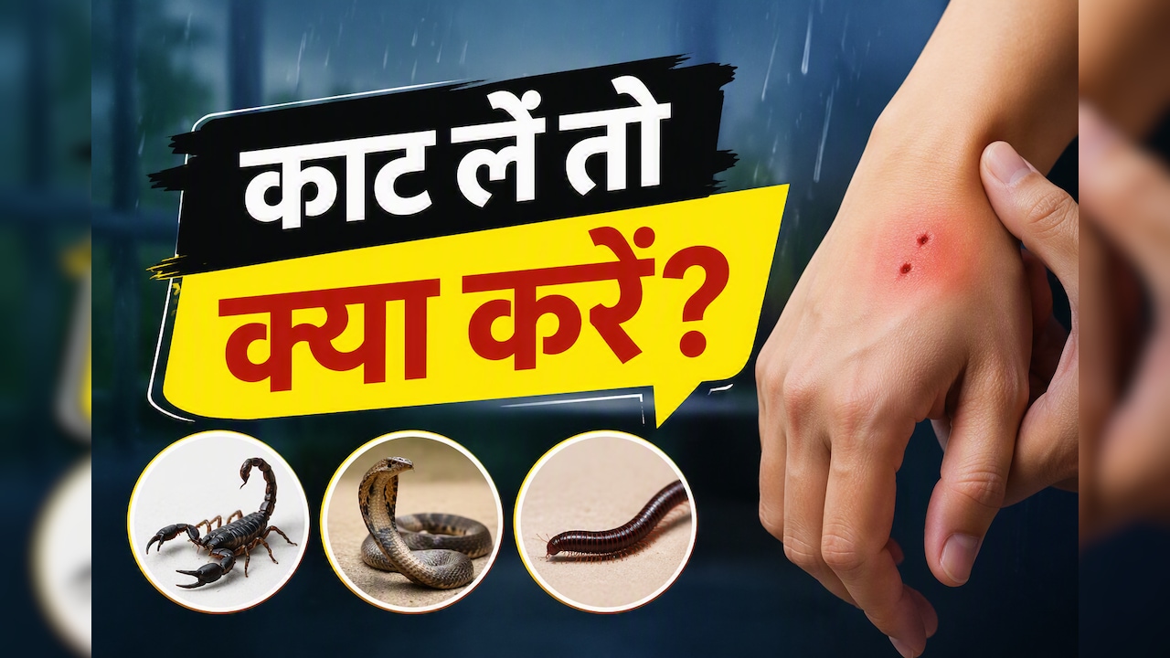 बारिश में घर में घुस आए बिच्छू, सांप या कनखजूरा? काट लें तो सबसे पहले करें ये काम
