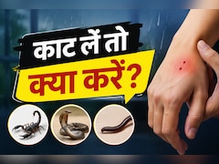 बारिश में घर में घुस आए बिच्छू, सांप या कनखजूरा? काट लें तो सबसे पहले करें ये काम