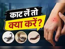बारिश में घर में घुस आए बिच्छू, सांप या कनखजूरा? काट लें तो सबसे पहले करें ये काम