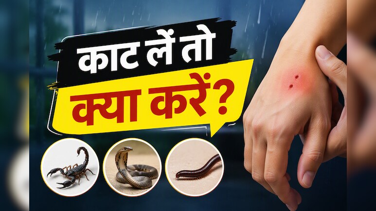 बारिश में घर में घुस आए बिच्छू, सांप या कनखजूरा? काट लें तो सबसे पहले करें ये काम