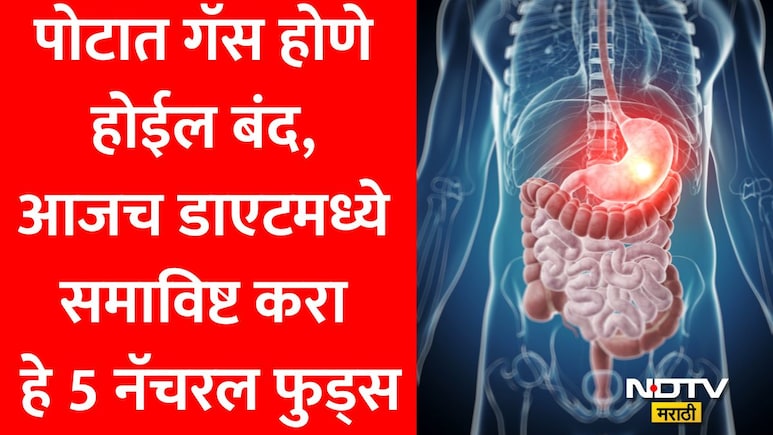 Acidity Remedies: पोटातील जळजळ आणि ॲसिडिटीने त्रस्त आहात? न्युट्रिशनिस्ट लवनीत बत्रांनी सांगितले 5 सोपे उपाय