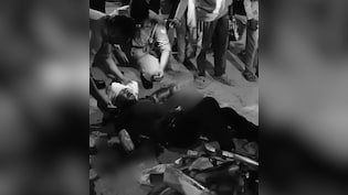 Man Attacked With Axe, Hands Chopped Off At UP Petrol Pump After Fight