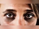 क्या रात में ज्यादा सोने से Dark Circles ठीक हो सकते हैं? स्किन की डॉक्टर से जानें कैसे लाइट होंगे आंखों के नीचे पड़े काले गड्ढे