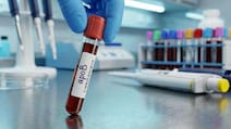 Your Standard Cholesterol Test May Miss Heart Attack Risk, Warns Study