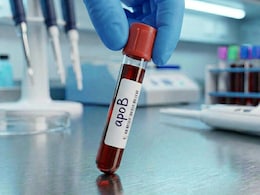 Are You Getting The Wrong Cholesterol Test? Study Says Your Standard Test May Miss Heart Attack Risks