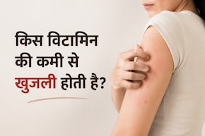 मौसम है या किसी विटामिन की कमी, क्या है शरीर में खुजली की वजह? इस तरह पा सकते हैं राहत