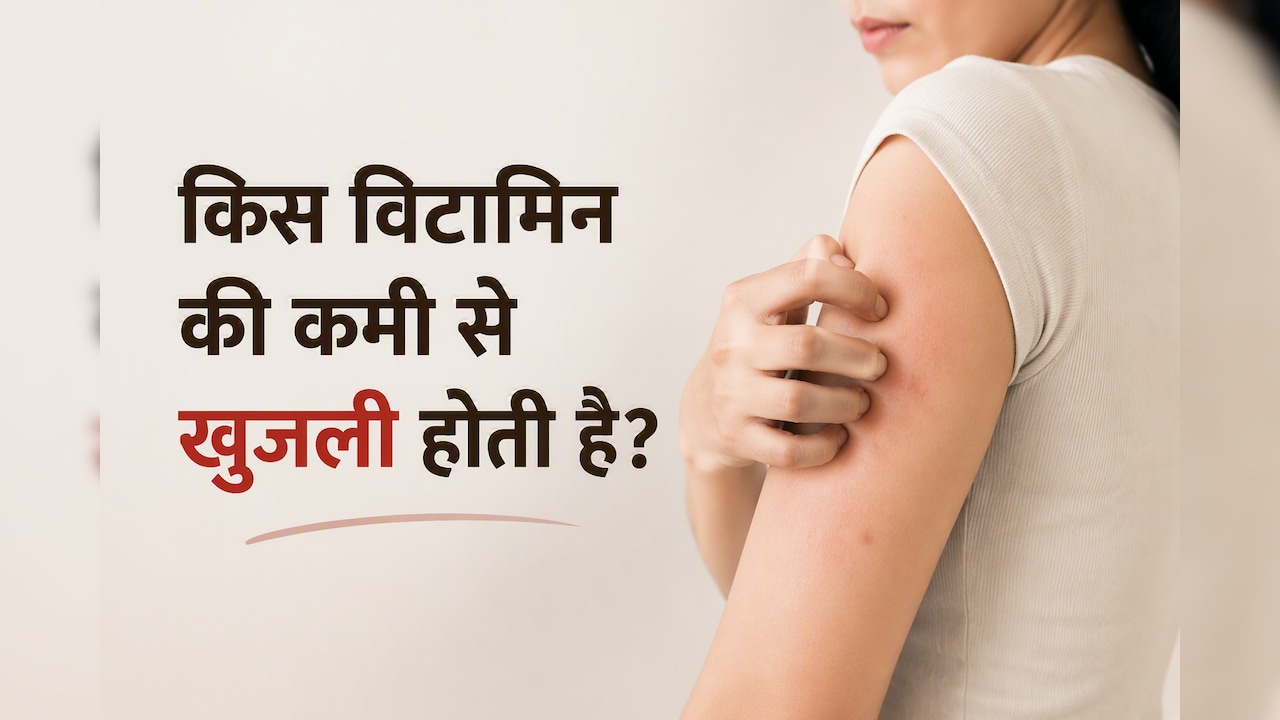 मौसम है या किसी विटामिन की कमी, क्या है शरीर में खुजली की वजह? इस तरह पा सकते हैं राहत
