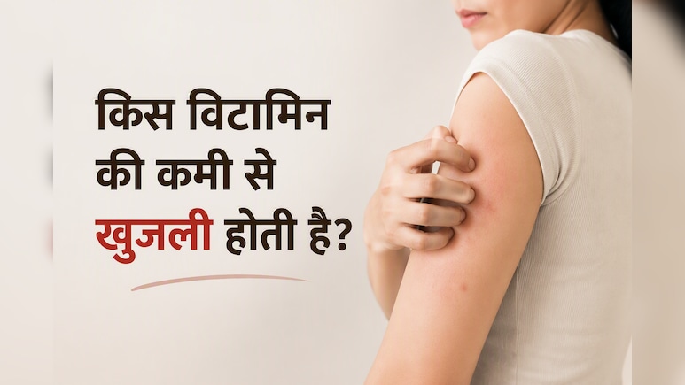 मौसम है या किसी विटामिन की कमी, क्या है शरीर में खुजली की वजह? इस तरह पा सकते हैं राहत