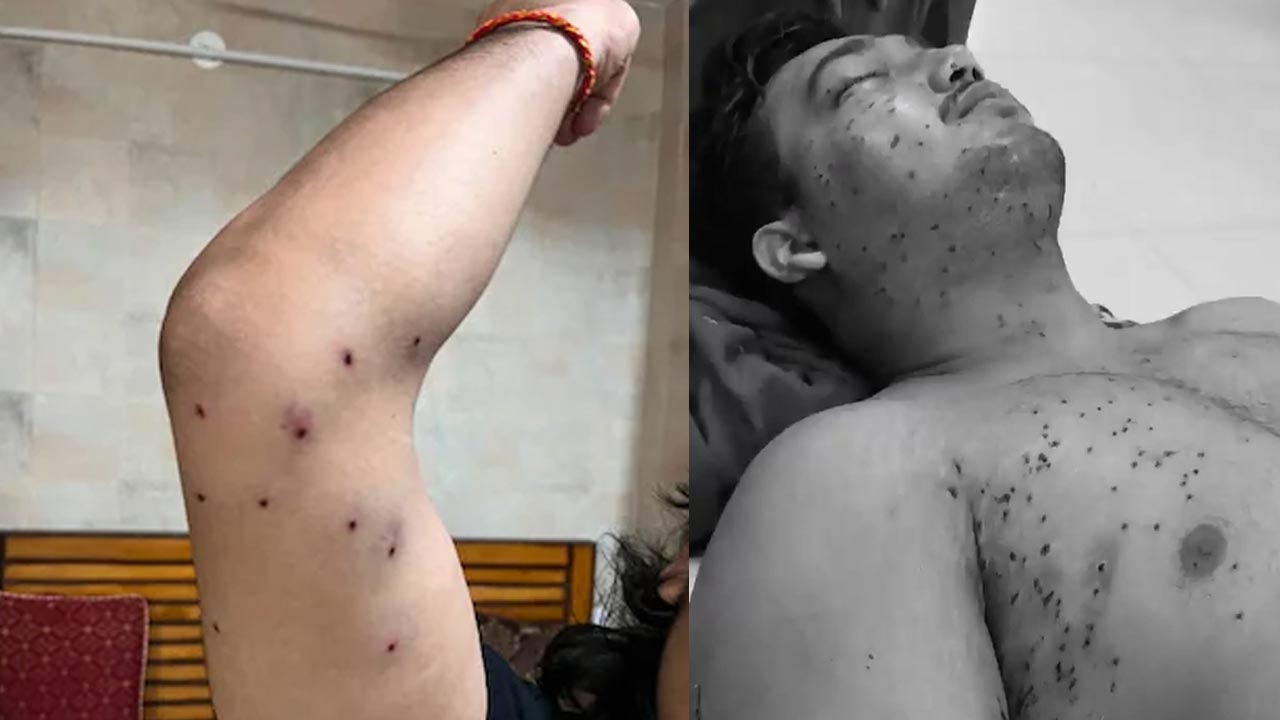 Anti-Riot Cops Who Used Pellet Guns On Protesters Identified, CRPF Probes