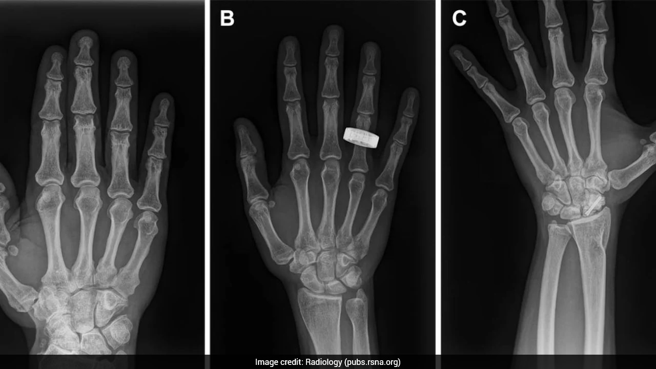 First Human X-Rays Captured In Space Mark Major Breakthrough For Astronaut Health